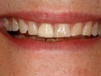 Konig Center for Cosmetic & Comprehensive Dentistry smile photos